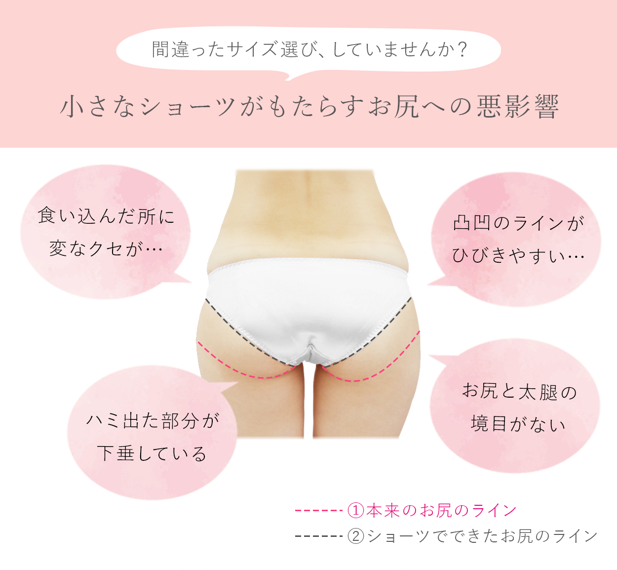 サイズの合わないショーツがもたらすお尻への悪影響