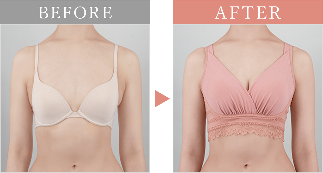 ビフォーアフター