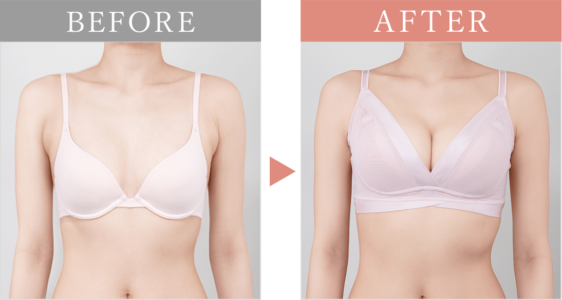 ビフォーアフター